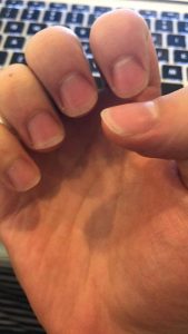 The Ultimate Guide To Stop Biting Your Nails | Pavlok